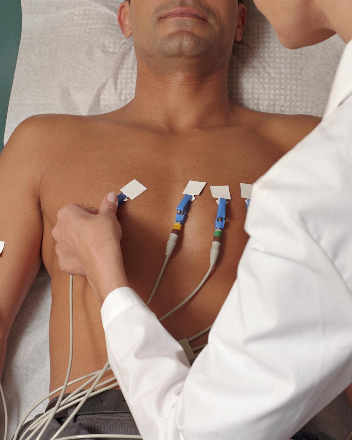 EKG