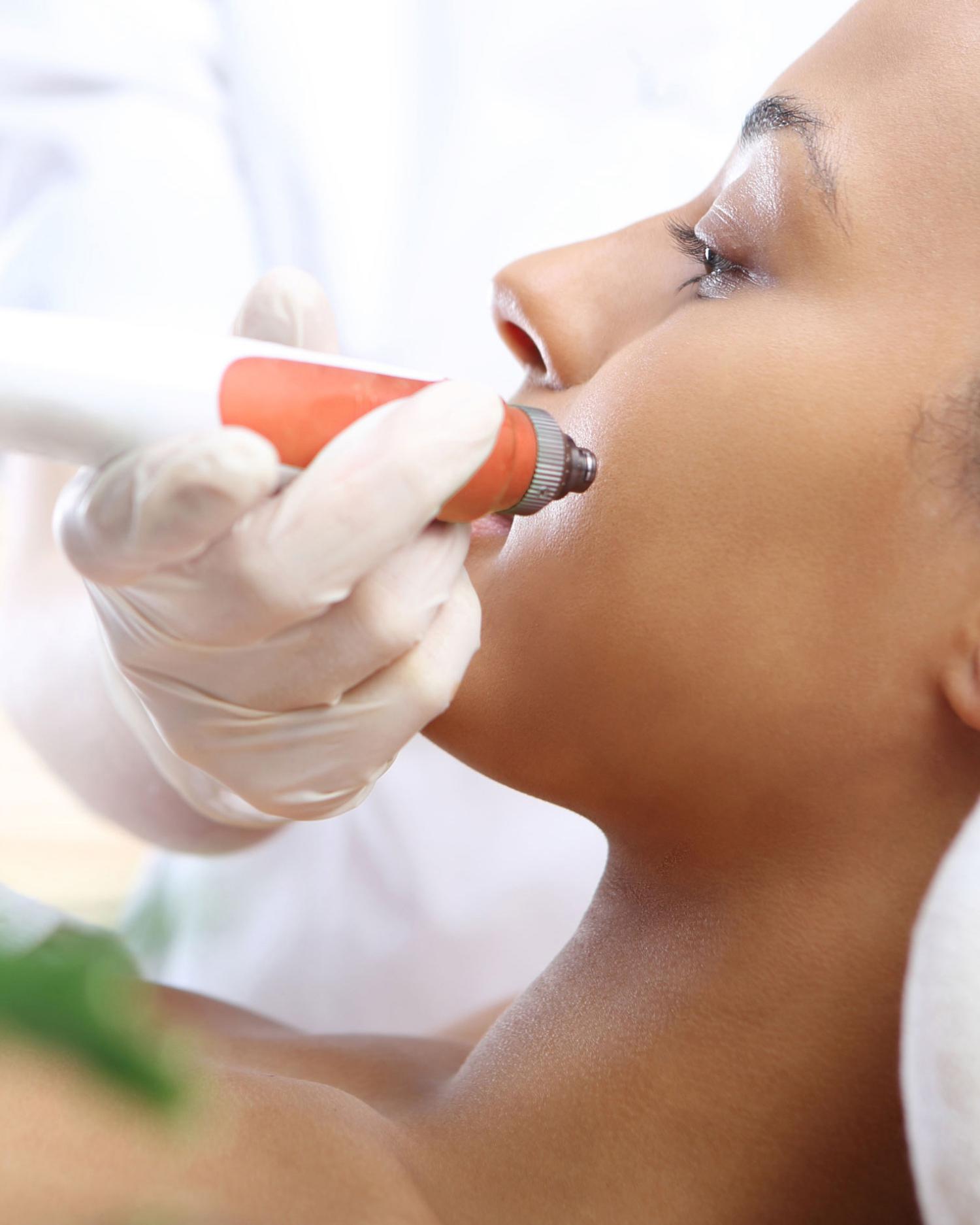Close-up image of medical spa treatment